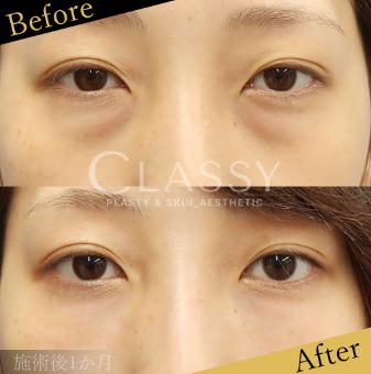 CLASSY 仙台美容外科・美容皮膚科症例写真